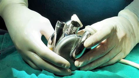 artificial heart company.